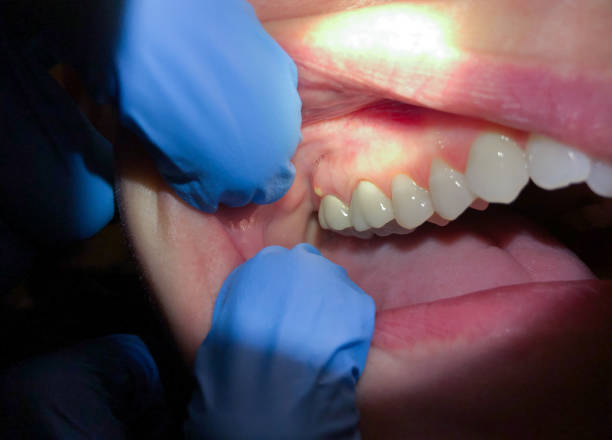 Best Emergency Broken Tooth Repair in Peridot, AZ