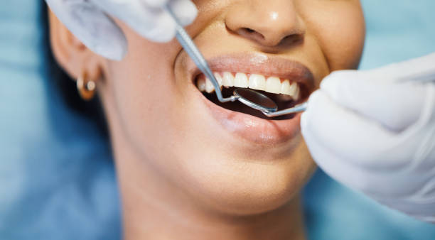 Best Emergency Tooth Extraction in Peridot, AZ